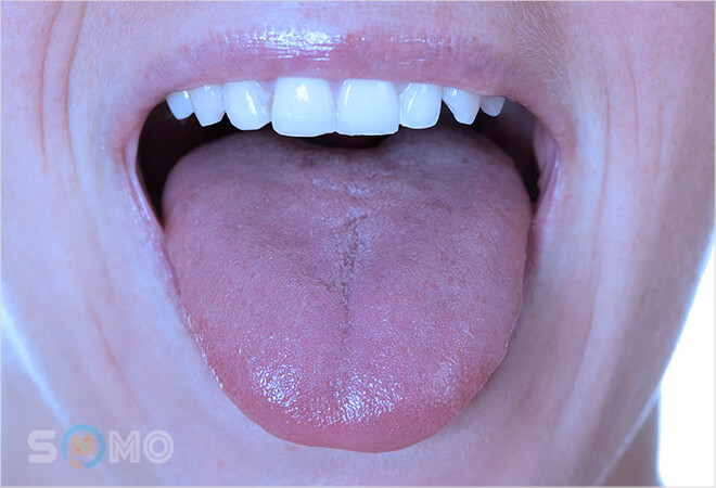 mơ thấy bị bỏng vào mồm