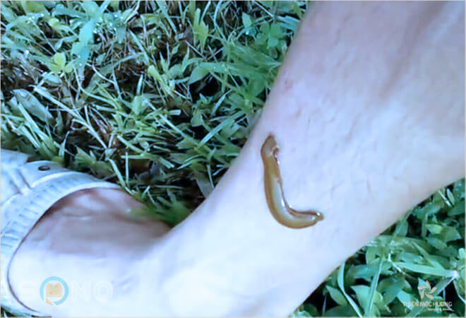 mơ thấy đỉa cắn người đánh con gì