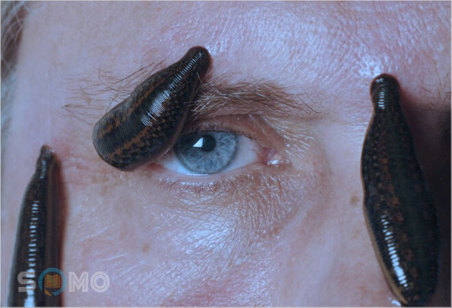 mơ thấy đỉa bám đầy người đánh con gì