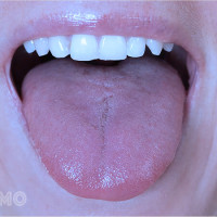 Bị bỏng vào mồm trong mơ là điềm gì? Xem ngay số lô đề chuẩn