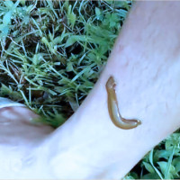 Mơ thấy đỉa cắn người là điềm báo gì? Giải mã chi tiết và con số lô đề may mắn